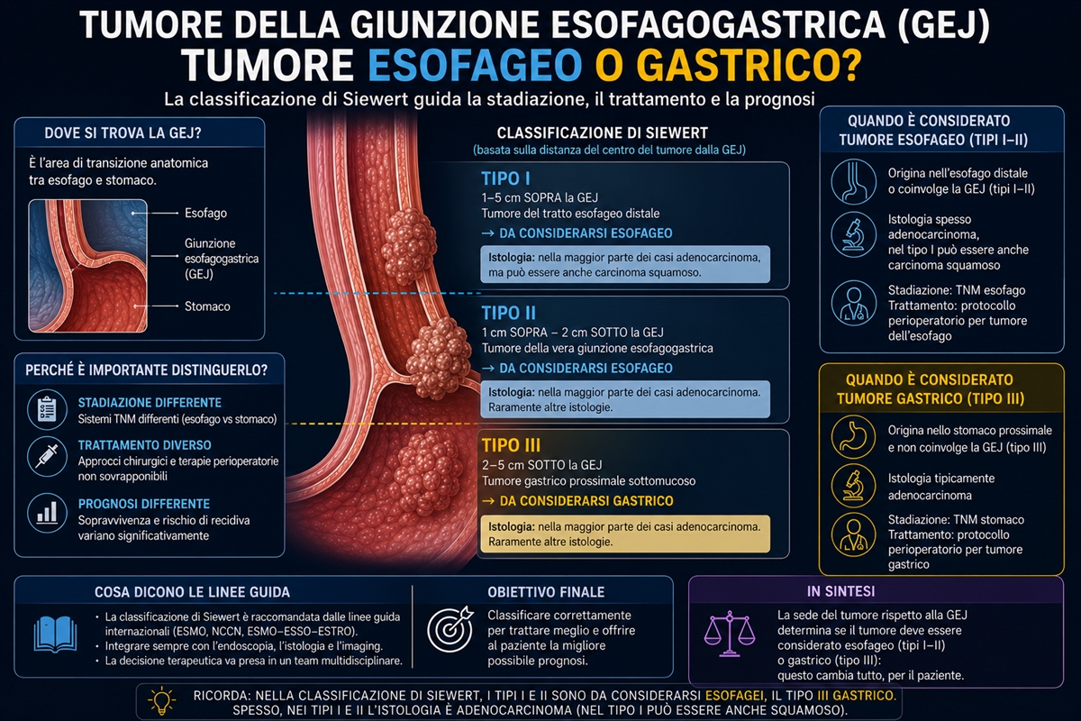 Il cancro della giunzione esofagogastrica: neoplasia gastrica o esofagea?